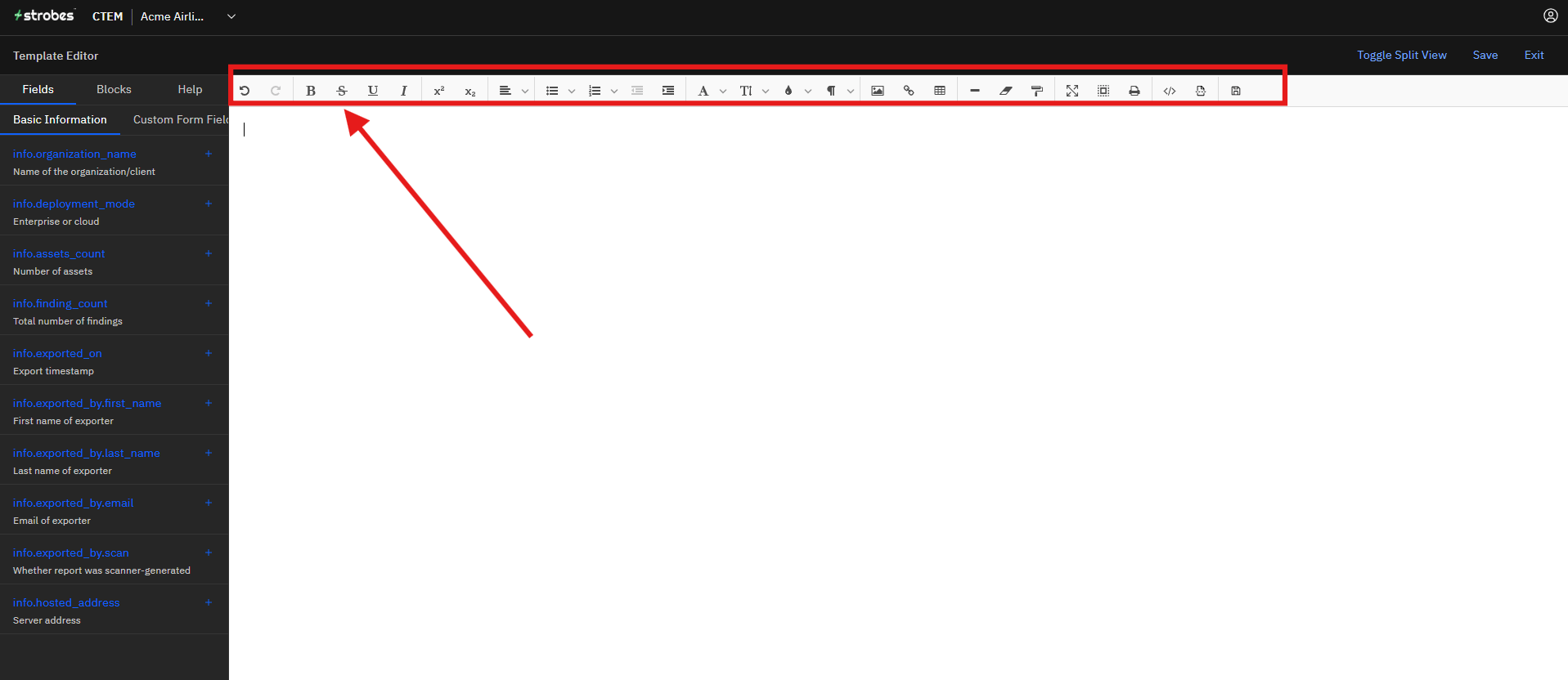Creating a Report Template: Step 3: Understand the Editor (screenshot 9)
