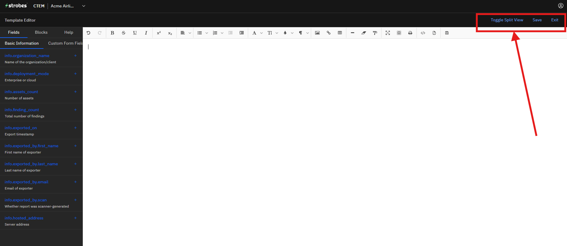 Creating a Report Template: Step 3: Understand the Editor (screenshot 10)